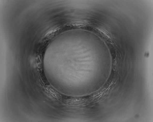 X0000101170917200806271030