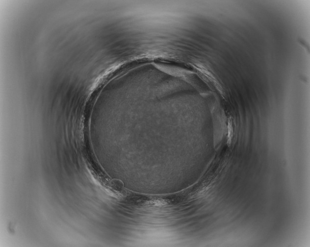 X0000101170492200807071225
