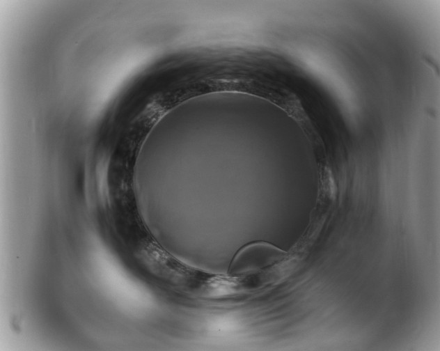 X0000101170526200807071224