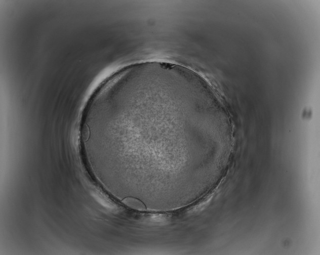 X0000101170056200807111101