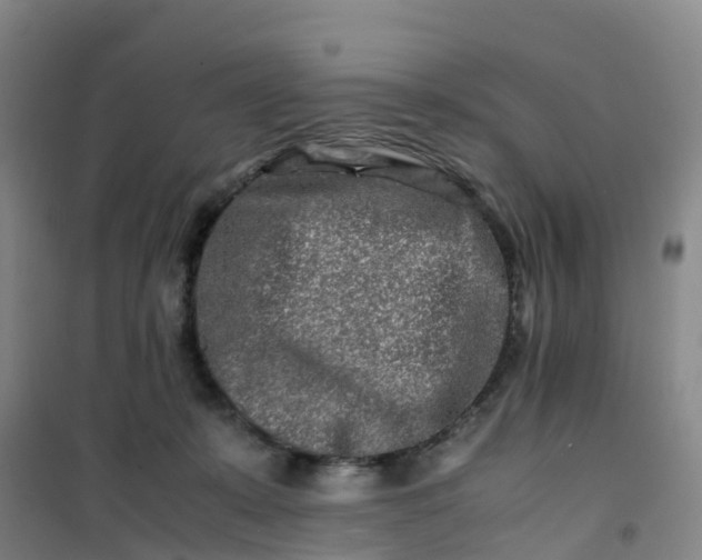 X0000101170319200807111058
