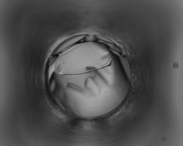 X0000101170200200807181431
