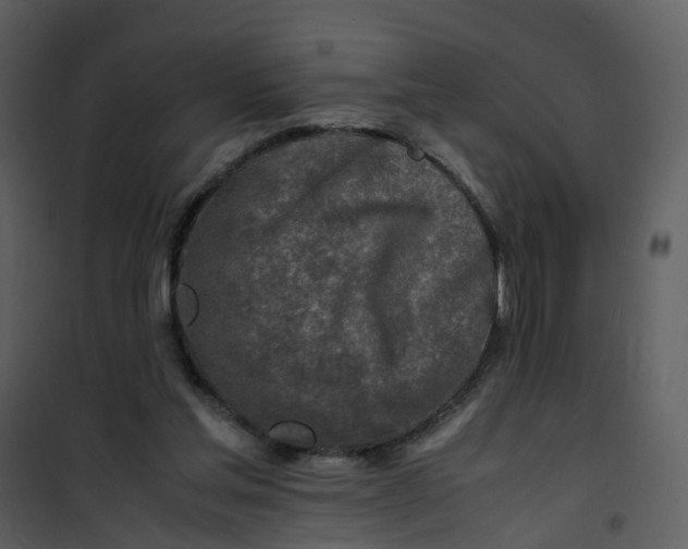 X0000101170205200807181431