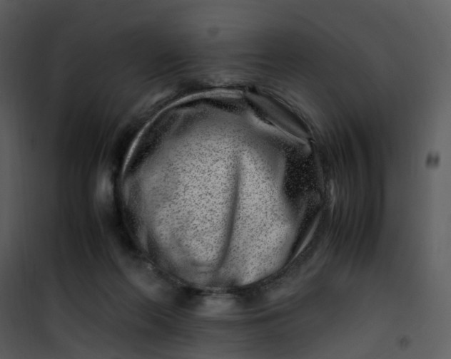 X0000101170214200807181431