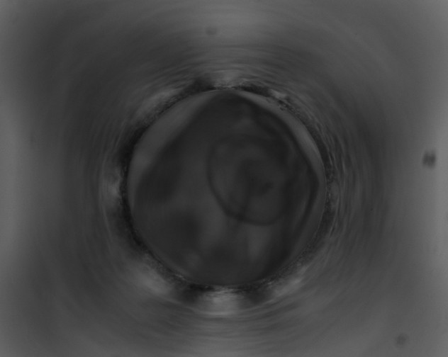 X0000101170219200807181431