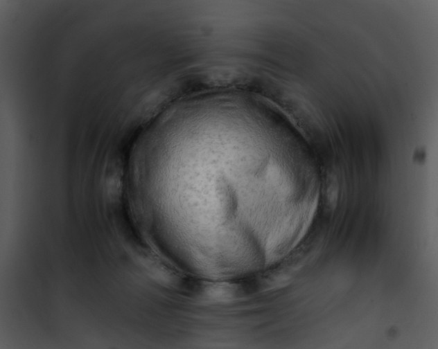 X0000101170226200807181431
