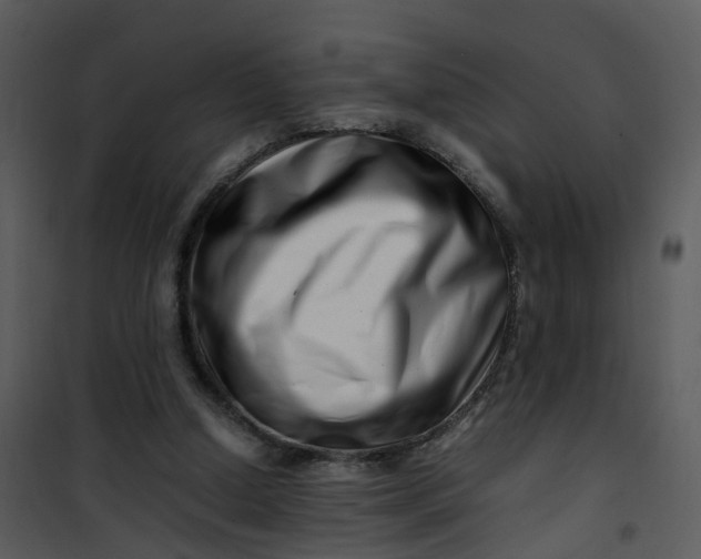 X0000101170250200807181430