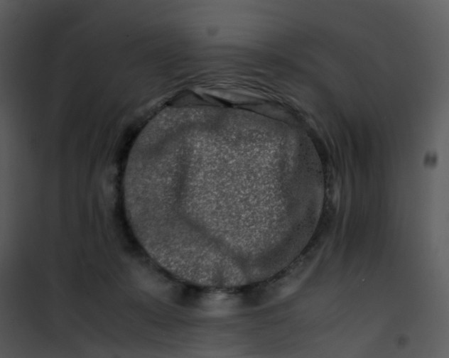 X0000101170319200807181429