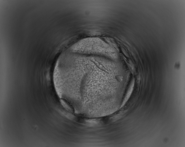 X0000101170516200807181426