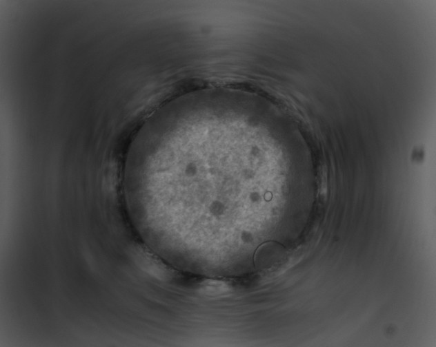 X0000101170519200807181426