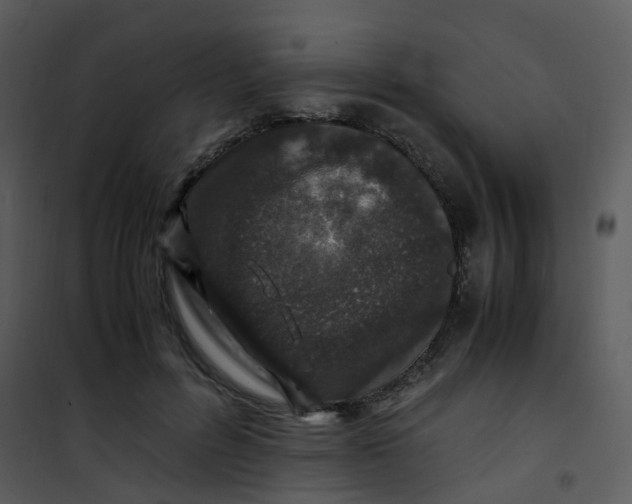 X0000101170600200807181425