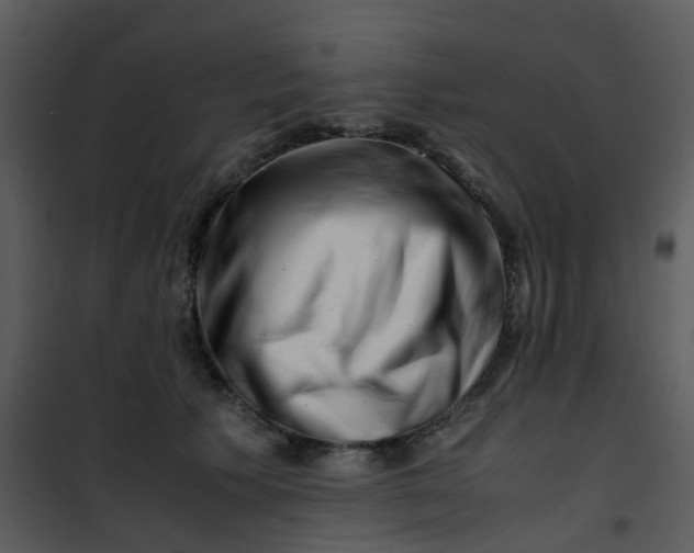 X0000101170609200807181425