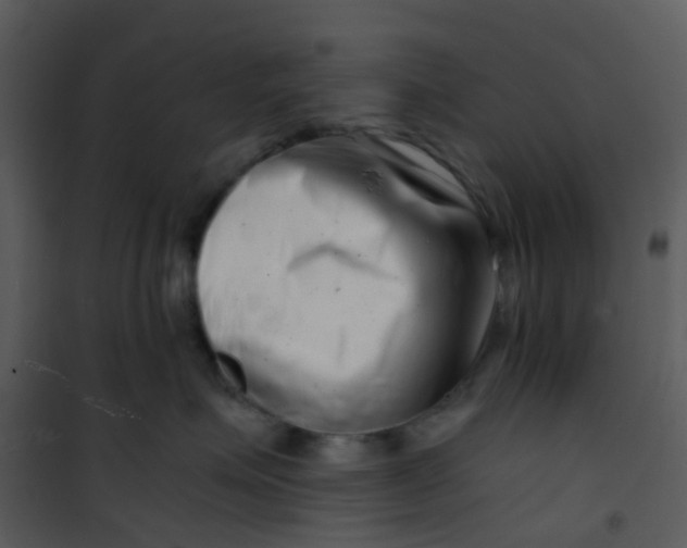X0000101170623200807181425