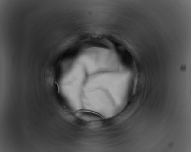 X0000101170719200807181423