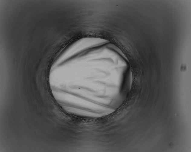 X0000101170817200807181421
