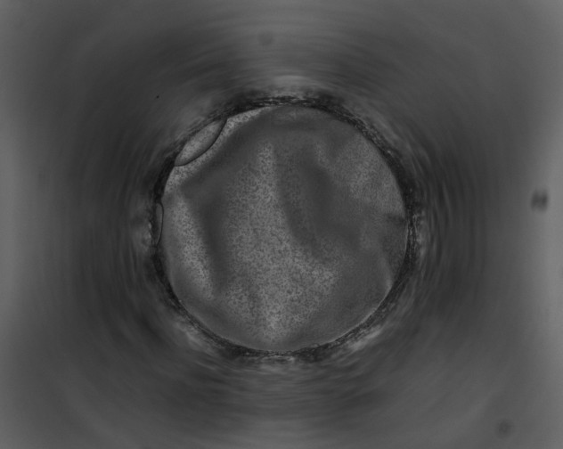 X0000101170916200807181420