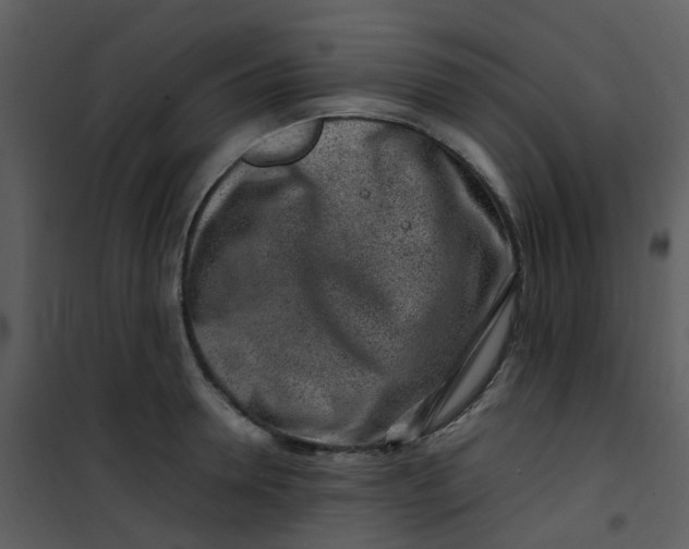 X0000101170946200807181420