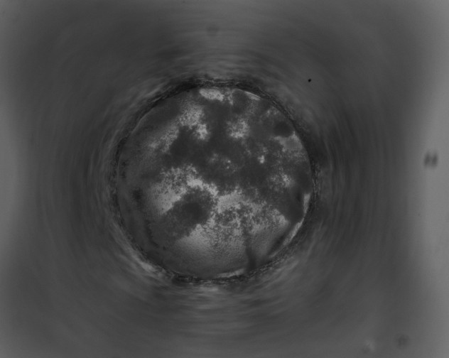 X0000101171009200807181418