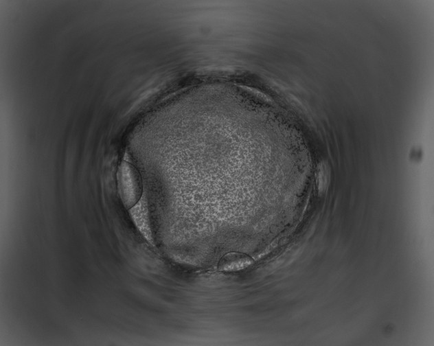X0000101171059200807181418
