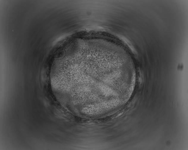X0000101171063200807181418