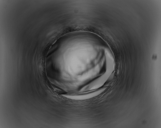 X0000101171250200807181415