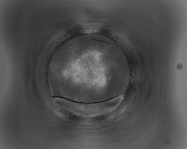 X0000101171441200807181411