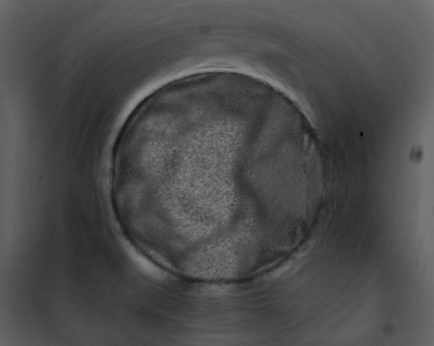 X0000101171519200807181410
