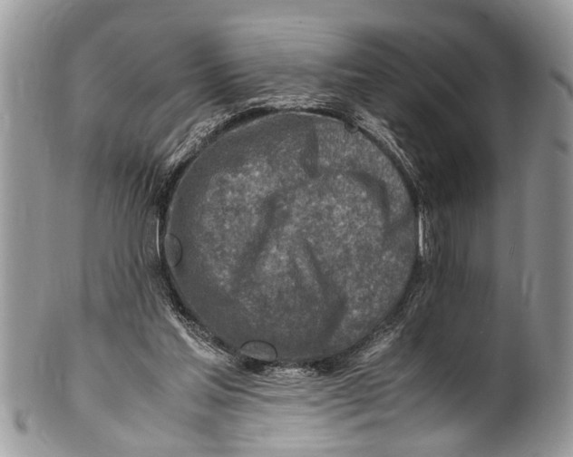 X0000101170205200807251140
