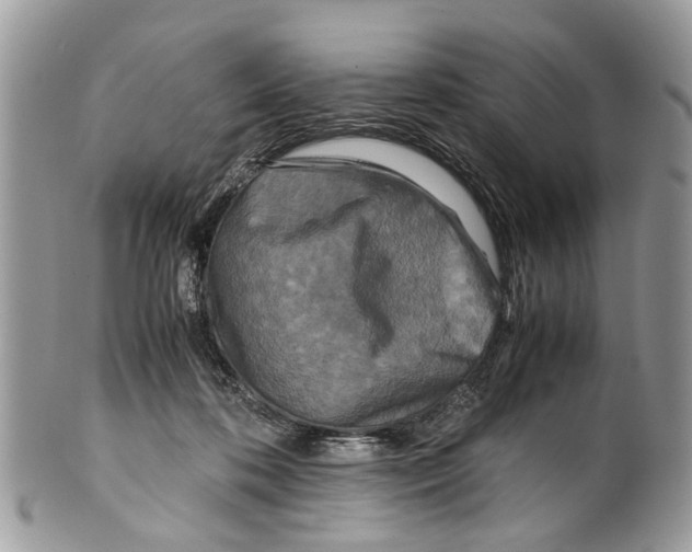 X0000101170316200807251138