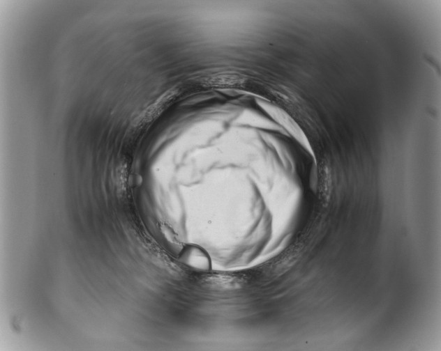 X0000101170326200807251138