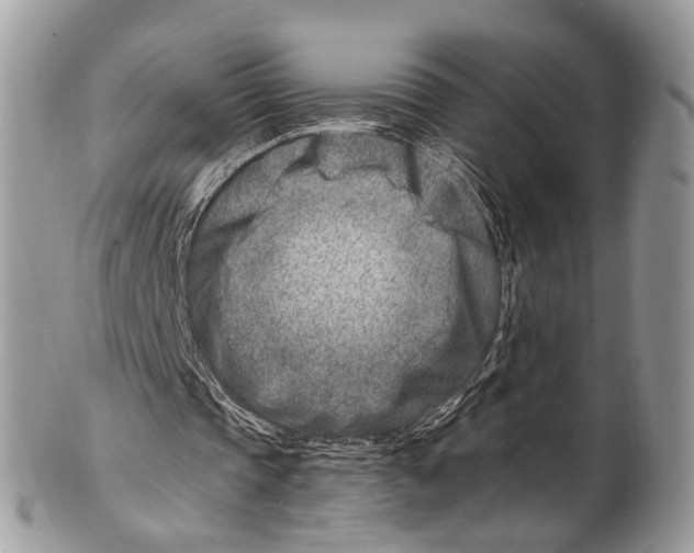 X0000101170337200807251137