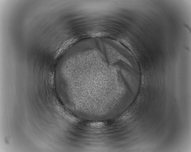 X0000101170357200807251138