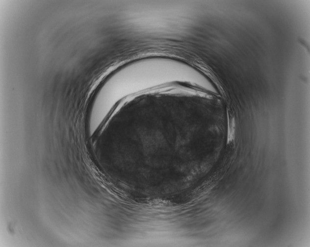 X0000101170387200807251137