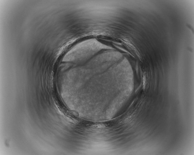 X0000101170492200807251136