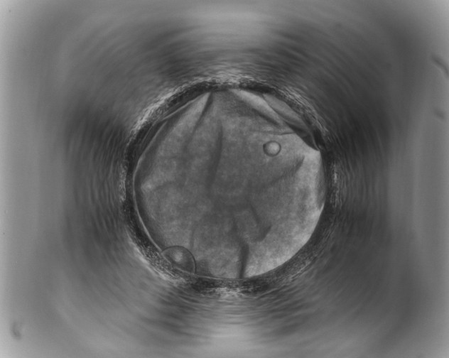 X0000101170496200807251136