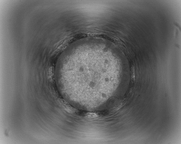 X0000101170519200807251135