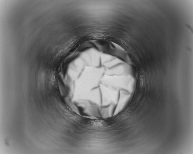 X0000101170618200807251134