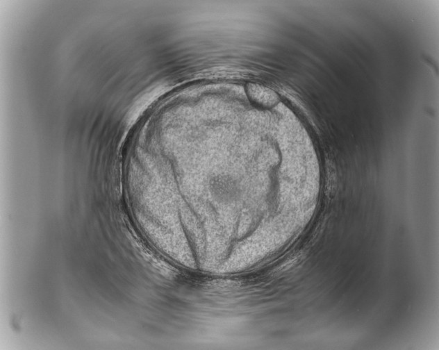 X0000101171075200807251127