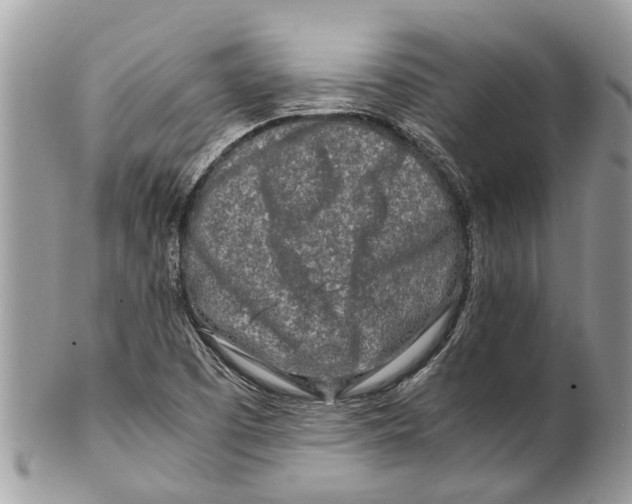 X0000101171457200807251122
