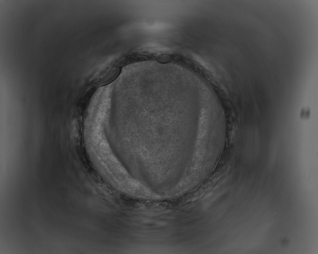 X0000101191397200807181500