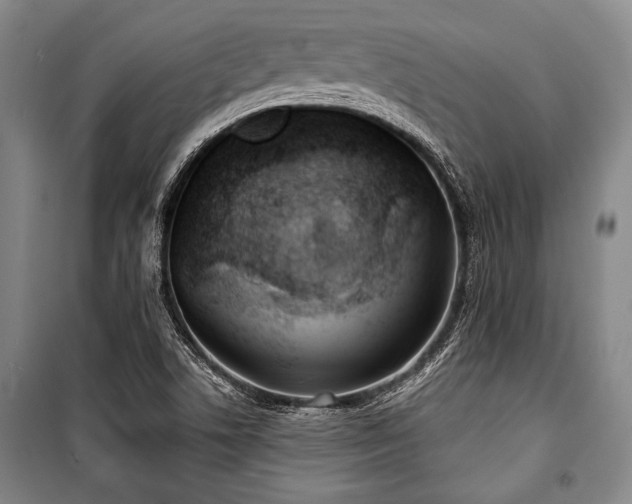 X0000101201506200806271338