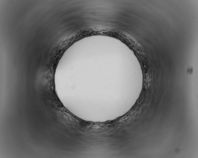 X0000101200917200807251022