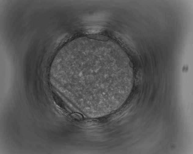 X0000101201441200807251014