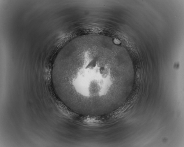 X0000101220177200806271456