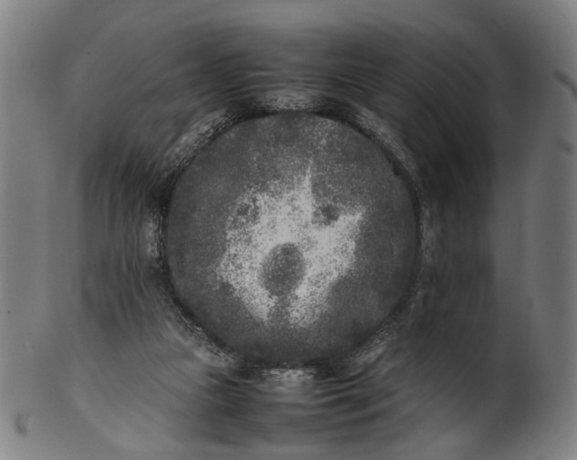 X0000101220161200807111105