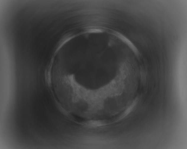X0000101391194200807071151