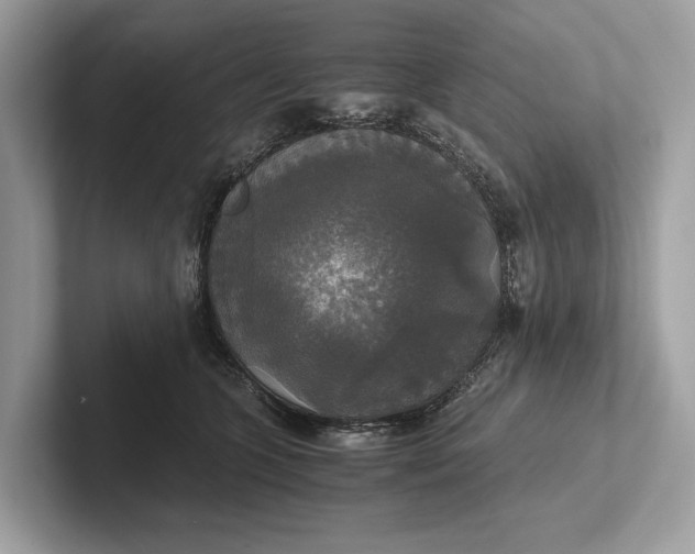 X0000101390563200807211015