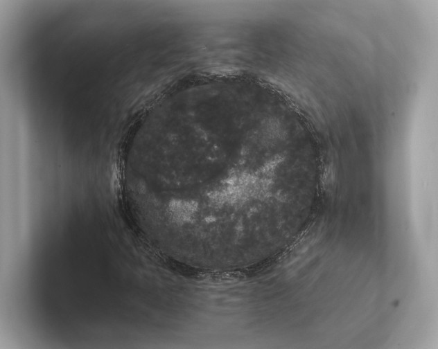 X0000101391397200807211003