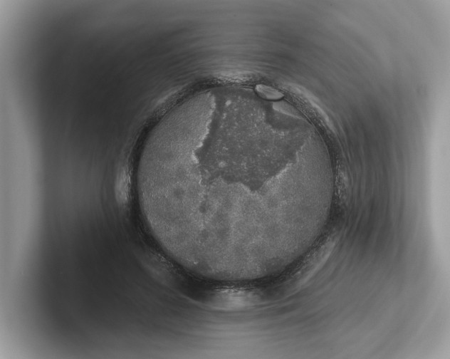 X0000101400596200807211036