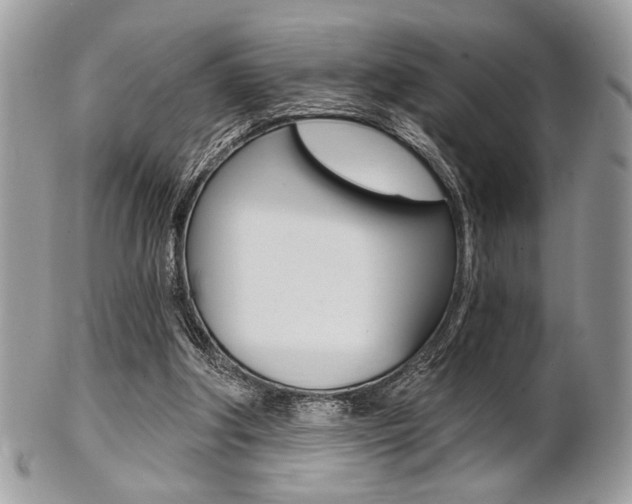X0000101410202200807071014
